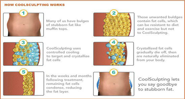 セリウムは脂肪質の非常に熱い機械 3 年の保証の cryolipolysis の承認しました