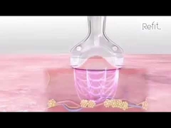 MLS05携帯用40Kキャビテーションの真空RFの超音波セルライトは装置を減らす