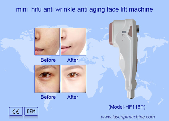 家庭用 HIFU 顔ケア 顔のしわ除去 肌の若返り 顔のリフティングマシン