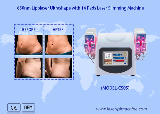 650nm Lipoレーザーはレーザーの脂肪吸引術機械にのための減らすセルライトの脂肪質の取り外しをパッドを入れる