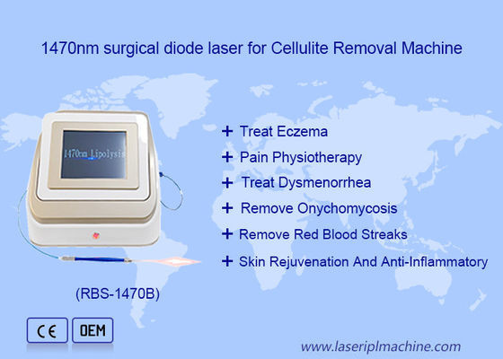 良い値段 1470nm 980nm ダイオードレーザー 脂分解 手術 レーザー装置 脂溶性 オンライン
