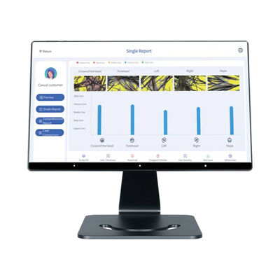良い値段 4 言語 スマート Al 頭皮分析器 髪頭皮ケア ターゲットヘッドマシン オンライン